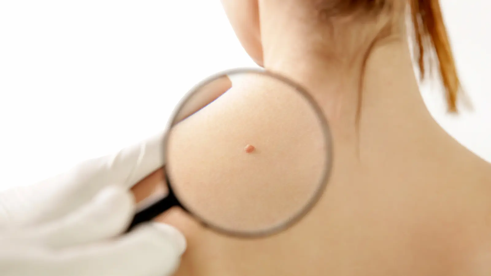 magnigying glass skin check